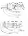 Fig. 08 - Method for anastomosis surgery using zip-ties