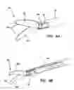 Fig. 04 - Laparoscopic scissors