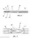 Fig. 06 - Laparoscopic scissors