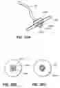 Fig. 43 - DEVICES, TOOLS AND METHODS FOR PERFORMING MINIMALLY INVASIVE ABDOMINAL SURGICAL PROCEDURES