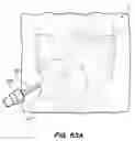 Fig. 77 - DEVICES, TOOLS AND METHODS FOR PERFORMING MINIMALLY INVASIVE ABDOMINAL SURGICAL PROCEDURES