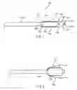 Fig. 02 - Pre-Clot Vessel Dilator