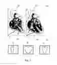 Fig. 09 - Bodily sealants and methods and apparatus for image-guided delivery of same