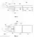 Fig. 02 - System and method for treating cervical vertebrae