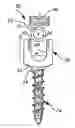 Fig. 01 - Dynamic intervertebral stabilization system