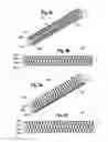 Fig. 03 - Rod-shaped implant, in particular for the dynamic stabilization of the spine