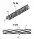 Fig. 04 - Rod-shaped implant, in particular for the dynamic stabilization of the spine