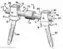Fig. 01 - Dynamic stabilization assembly with frusto-conical connection
