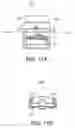Fig. 08 - Minimally invasive spinal stabilization system
