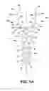 Fig. 02 - Bone plate with reduction aids and methods of use thereof