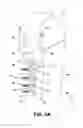 Fig. 08 - Bone plate with reduction aids and methods of use thereof