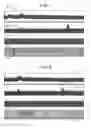 Fig. 06 - Electrical Treatment Of Bronchial Constriction