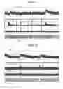 Fig. 08 - Electrical Treatment Of Bronchial Constriction