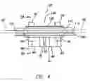 Fig. 07 - Implantable pulse generator EMI filtered feedthru