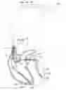 Fig. 01 - Steroid eluting pacing tip electrode