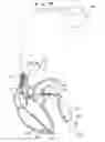Fig. 02 - Steroid eluting pacing tip electrode