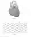 Fig. 02 - SLIDING RESTRAINT STENT DELIVERY SYSTEMS