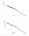 Fig. 07 - SLIDING RESTRAINT STENT DELIVERY SYSTEMS