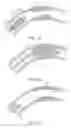 Fig. 02 - Endoprostheses