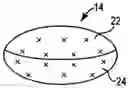 Fig. 01 - Prosthetic heart valve devices and methods of valve replacement