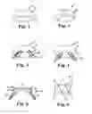 Fig. 02 - Prosthetic heart valve devices and methods of valve replacement