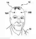 Fig. 01 - CUSTOMIZATION OF IMPLANTABLE MEDICAL DEVICES