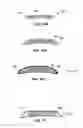 Fig. 08 - CUSTOMIZATION OF IMPLANTABLE MEDICAL DEVICES