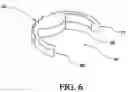 Fig. 07 - EXPANDABLE INTERVERTEBRAL IMPLANT