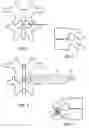 Fig. 02 - Implant device and method for interspinous distraction