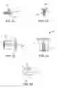 Fig. 06 - Implant device and method for interspinous distraction