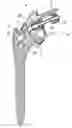 Fig. 01 - SHOULDER PROSTHESIS AND SET OF INSTRUMENTS FOR THE IMPLANTATION THEREOF