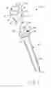 Fig. 02 - Ulnar head prosthesis system