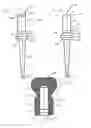 Fig. 09 - Ulnar head prosthesis system