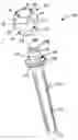 Fig. 01 - Ulnar head prosthesis system