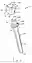 Fig. 02 - Ulnar head prosthesis system