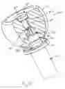 Fig. 09 - Ulnar head prosthesis system