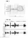 Fig. 02 - Display digital signal visualizations with increasing accuracy