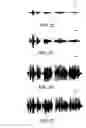 Fig. 22 - Compression for speech intelligibility enhancement