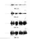 Fig. 22 - Speech intelligibility enhancement system and method