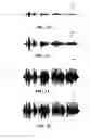 Fig. 22 - DISPERSION FILTERING FOR SPEECH INTELLIGIBILITY ENHANCEMENT