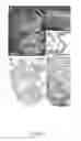 Fig. 08 - Neurotrophic factor MANF and uses thereof