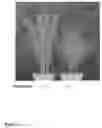 Fig. 02 - Gene regulating tillering and leaf morphology in plant and utilization of the same