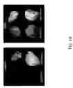 Fig. 08 - Plant virus-based inducible expression system
