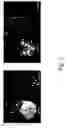 Fig. 09 - Plant virus-based inducible expression system