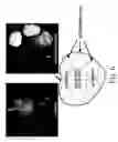 Fig. 10 - Plant virus-based inducible expression system