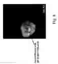 Fig. 12 - Plant virus-based inducible expression system