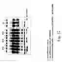 Fig. 16 - Plant virus-based inducible expression system