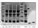 Fig. 01 - METHODS FOR THE PRODUCTION OF INSULIN IN PLANTS