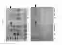 Fig. 08 - METHODS FOR THE PRODUCTION OF INSULIN IN PLANTS