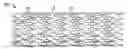 Fig. 01 - Method and apparatus for reducing stress during stent manufacture